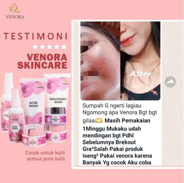 Promo Murah Kosmetik Kecantikan Venora Skincare